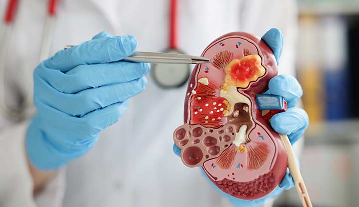 24214-nephrologist